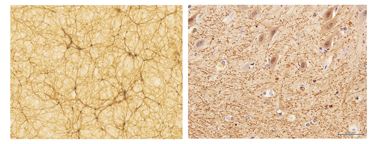 Figure 2: Simulated image of the universe compared to a scan of neurons in the human brain, showing striking structural similarity.